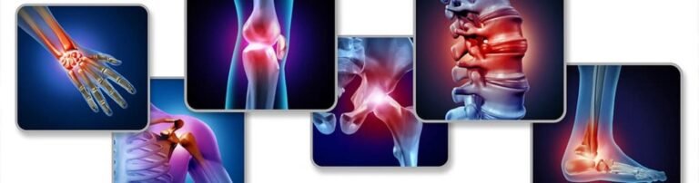 ARTHRITIS WITH AYURVEDA